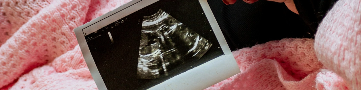 A hand holds a black-and-white ultrasound printout over a pink blanket.